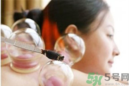 肩膀酸痛可以拔火罐嗎？孕婦肩膀酸痛能拔火罐嗎？