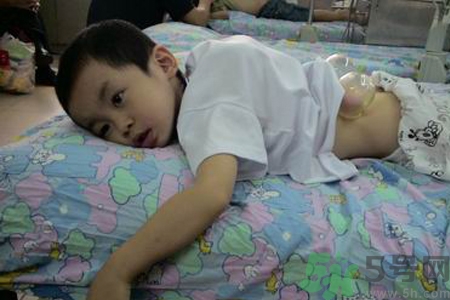 小孩可以拔罐嗎？寶寶能拔火罐嗎？
