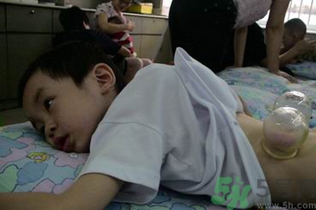小孩可以拔罐嗎？寶寶能拔火罐嗎？