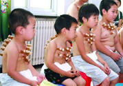 小孩可以拔罐嗎？寶寶能拔火罐嗎？