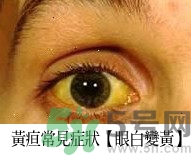 上腹部不舒服有時疼痛會不會是胰臟癌？