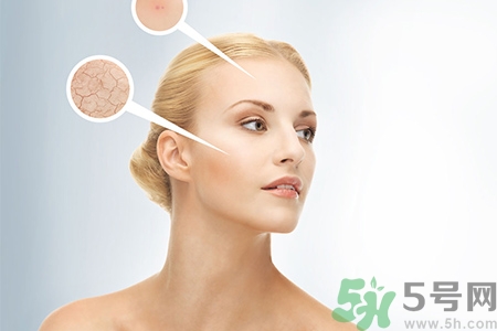 甘油會(huì)堵塞毛孔嗎？甘油堵塞毛孔怎么辦？
