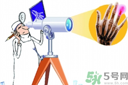 什么年齡測(cè)骨齡最好？如何測(cè)骨齡？