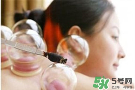 拔罐放血對身體好嗎？拔罐放血有什么好處？