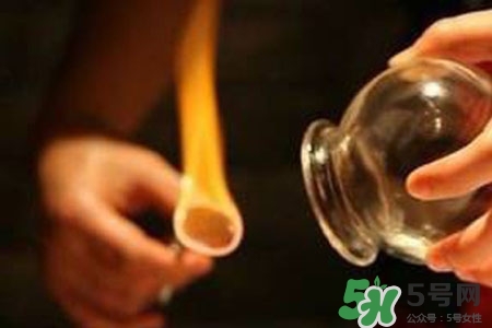 拔罐放血對身體好嗎？拔罐放血有什么好處？