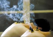 落枕能艾灸嗎？艾灸治療落枕有用嗎？