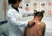 刮痧后什么顏色才健康？刮痧顏色反映的病癥