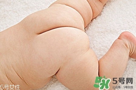 擴(kuò)肛疼嗎？擴(kuò)肛手術(shù)會很疼嗎？