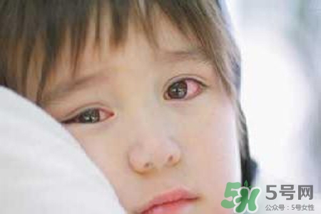 孩子為什么老眨眼睛？孩子總眨眼睛怎么回事？