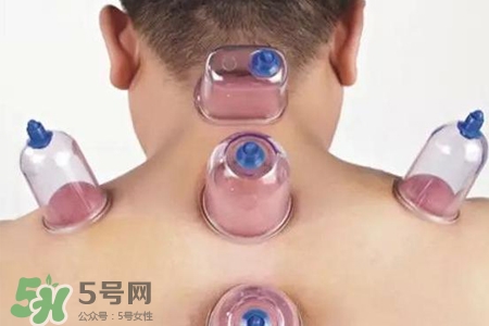 拔罐后可以喝酒嗎？拔罐后多久能喝酒？