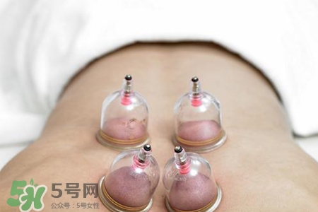 拔罐后可以貼膏藥嗎？拔罐后多久能貼膏藥？