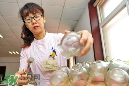拔罐胃口會變好嗎？拔罐胃口變好怎么回事？