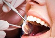 拔牙之后可以吃藥嗎？拔牙之后要不要吃藥？