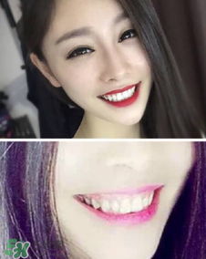 碧緹福冷光牙齒美白儀怎么用？碧緹福冷光牙齒美白儀使用方法