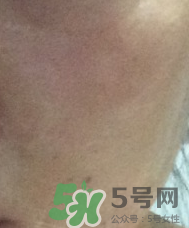 skin1004是什么牌子？skin1004屬于什么檔次