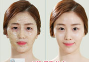 skin1004是什么牌子？skin1004屬于什么檔次