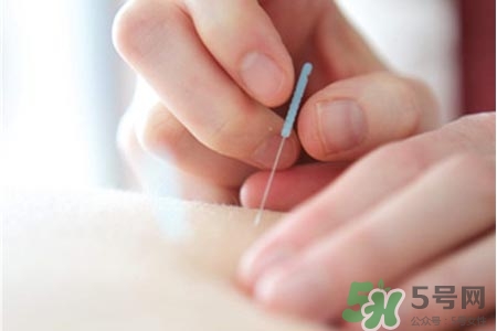 腰間盤突出可以針灸嗎？針灸能治腰間盤突出嗎？