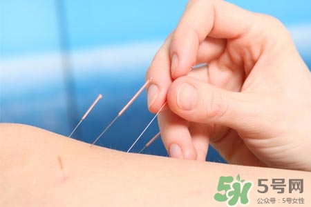 腰間盤突出可以針灸嗎？針灸能治腰間盤突出嗎？