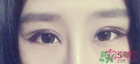 切開雙眼皮多久消腫？切開雙眼皮多久恢復(fù)？