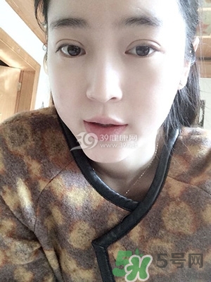 什么是定點雙眼皮？定點雙眼皮多少錢？