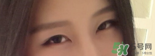 切開雙眼皮多久消腫？切開雙眼皮多久恢復(fù)？