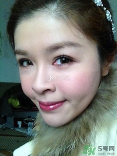 重瞼術是什么？重瞼術是永久的嗎？