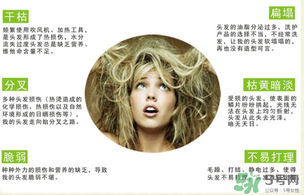 N7發(fā)膜多少錢一盒？N7發(fā)膜價(jià)格