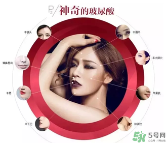 喬雅登是哪個(gè)國(guó)家的？喬雅登玻尿酸哪個(gè)國(guó)家？