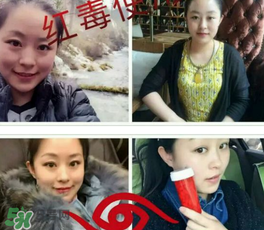 美國(guó)紅毒溶脂怎么樣？美國(guó)紅毒溶脂有用嗎？