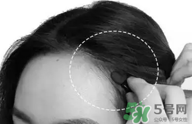 發(fā)際線高適合什么發(fā)型？發(fā)際線高怎么辦