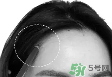 發(fā)際線高適合什么發(fā)型？發(fā)際線高怎么辦