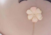 妊娠線每個(gè)孕婦都有嗎？妊娠線出現(xiàn)的時(shí)間