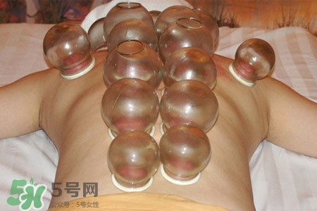 冬天可以拔罐放血嗎？冬天拔罐放血好嗎？