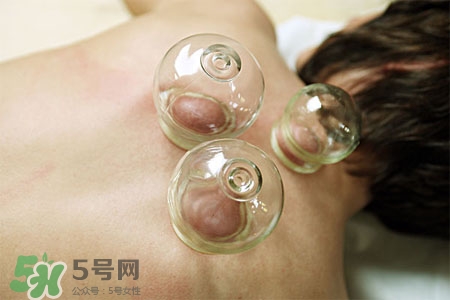 拔罐放血會(huì)得傳染病么？拔罐放血會(huì)傳染疾病嗎？