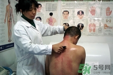 刮痧可以去濕氣嗎？體內(nèi)濕氣重刮痧有用嗎？