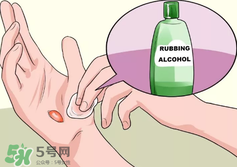 水泡怎么處理？水泡要不要刺破？