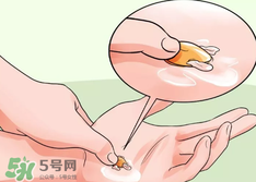 水泡怎么處理？水泡要不要刺破？