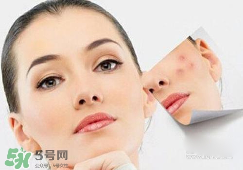 封閉性粉刺會(huì)自己消失嗎？封閉性粉刺好了會(huì)留疤嗎？