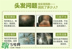 牛角梳梳頭可以生發(fā)嗎？牛角梳怎么梳頭？