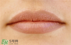 卡唇紋是什么意思？卡唇紋怎么辦？