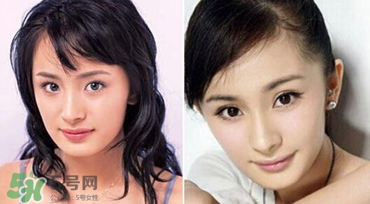 打瘦臉針能懷孕嗎？打瘦臉針能吃避孕藥嗎？