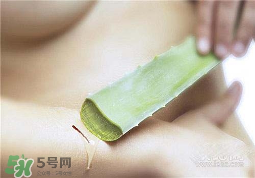 蘆薈涂在臉上發(fā)癢是怎么回事？蘆薈涂在臉上發(fā)癢怎么辦？