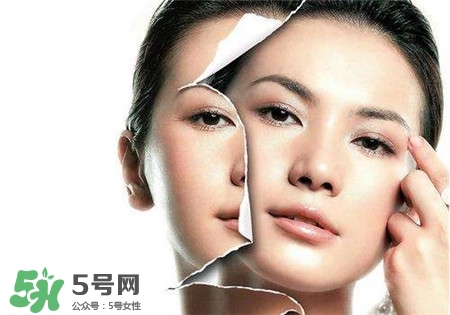 美白針是什么？美白針可以連續(xù)打嗎？