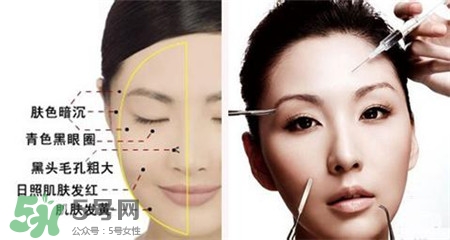 美白針的效果明顯嗎？美白針一個(gè)療程幾次？