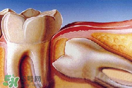 智齒會一直長嗎？智齒會停止生長嗎？