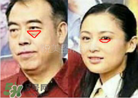 臥蠶是黑眼圈嗎？臥蠶和黑眼圈的區(qū)別