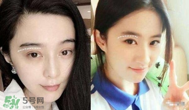 割雙眼皮有幾種做法？雙眼皮有哪幾種形狀？