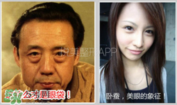 臥蠶是黑眼圈嗎？臥蠶和黑眼圈的區(qū)別