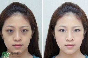 臥蠶是黑眼圈嗎？臥蠶和黑眼圈的區(qū)別