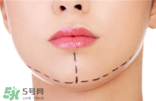 玻尿酸墊下巴能維持多久？玻尿酸墊下巴能維持多長時(shí)間？